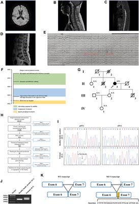 Case report: A novel WASHC5 variant altering mRNA splicing causes spastic paraplegia in a patient